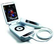 FOR SELL GE VSCAN ULTRASOUND SCANNER PRICE $5, 000 ALSO WE HAVE DIABETE