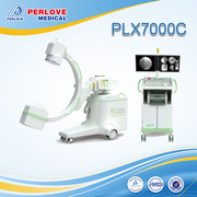 professional mobile C Arm equipment PLX7000C