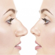 Find The Best Facelift Doctor in Jaipur